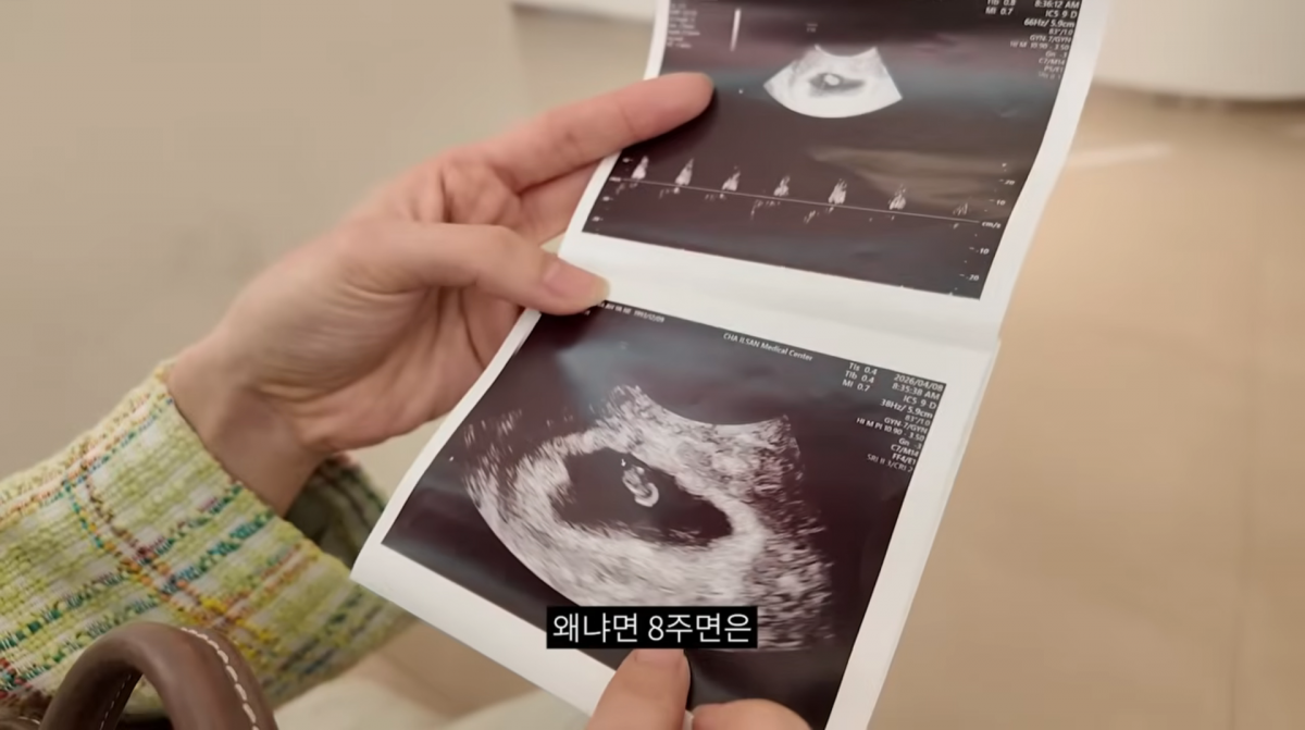 사진=유튜브 '이지훈 아야네의 지아라이프'