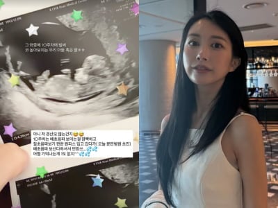 '이지훈♥' 아야네, 둘째 초음파 보고만 "10주차, 코 높아 보여"…벌써 도치맘 모드