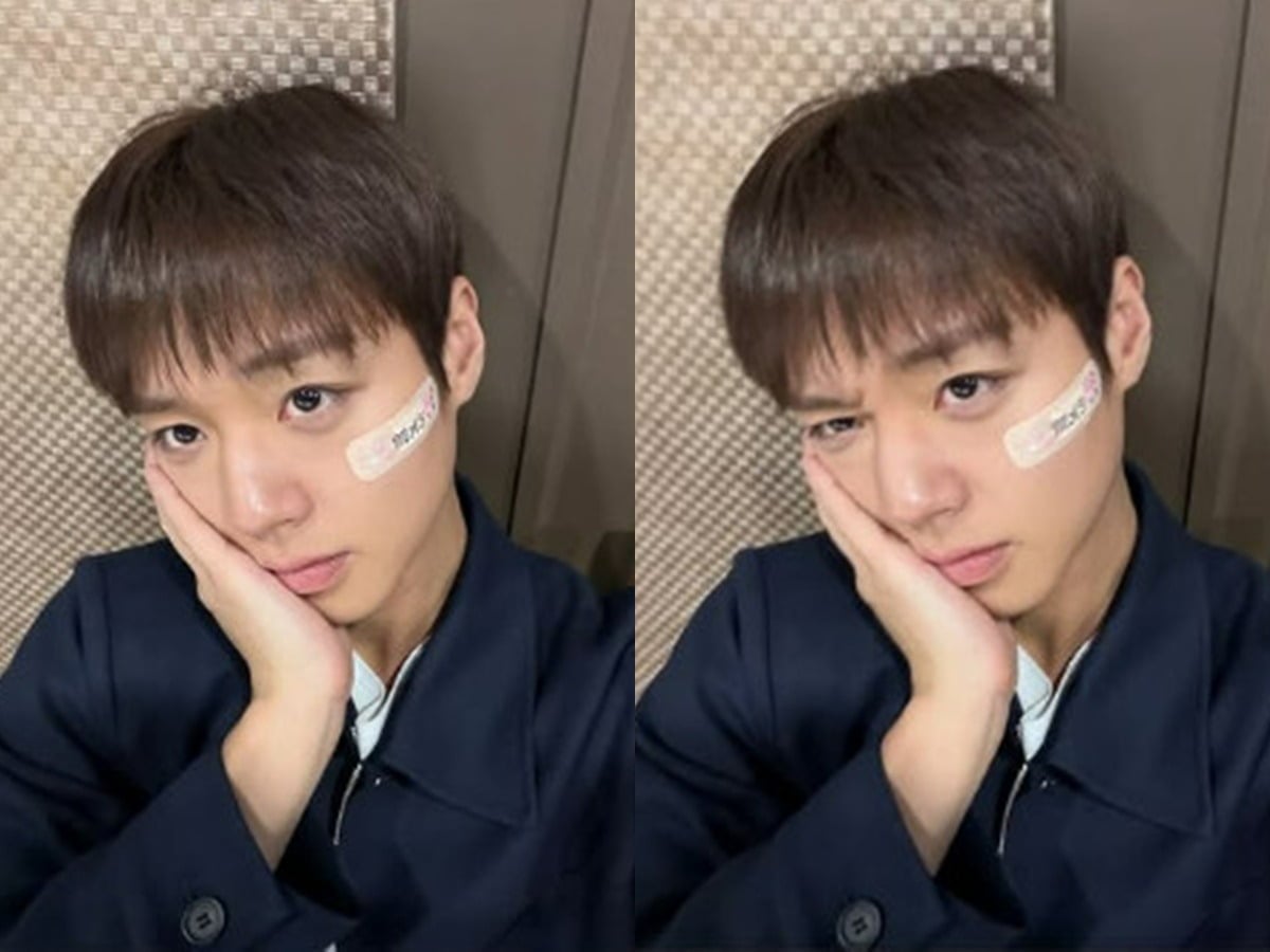 가수 겸 배우 박지훈이 오른쪽 뺨에는 'MAY'(팬덤 명)라고 적힌 밴드를 붙여 남다른 팬 사랑을 인증했다. / 사진=박지훈 SNS