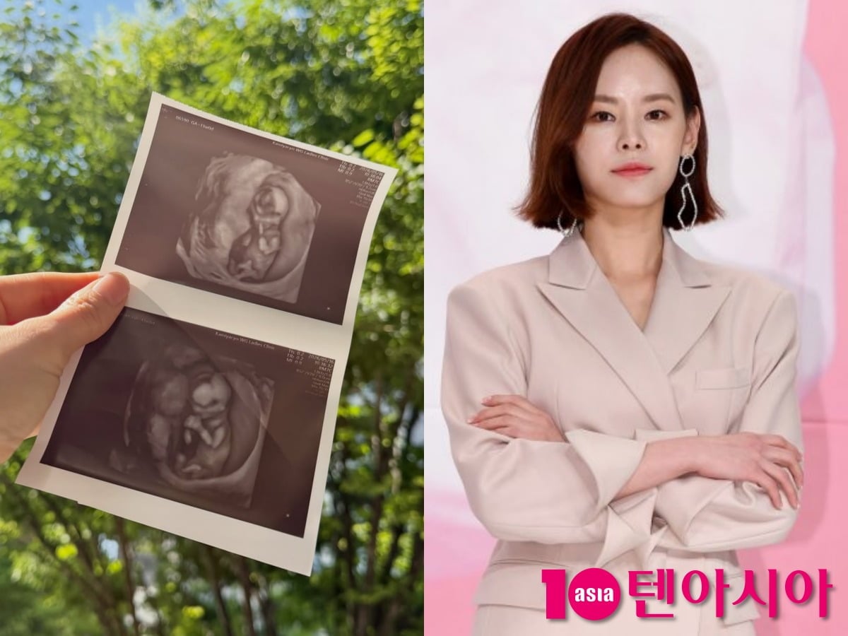 구재이가 둘째 임신 소식을 알렸다. / 사진=구재이 SNS, 텐아시아DB
