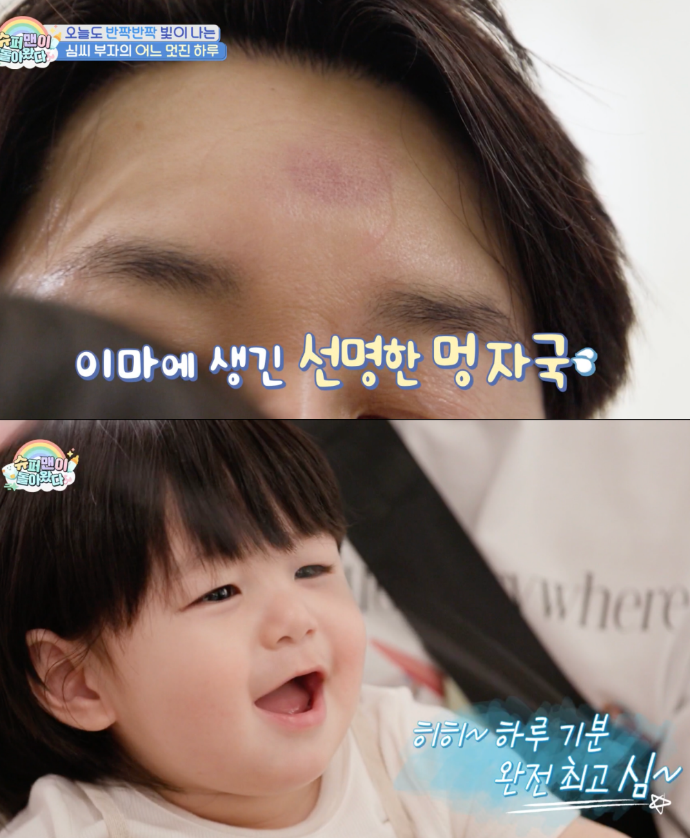 심형탁, 아들 광고 찍다 결국 부상…“멍들었지만 하루 미소 건졌다” (‘슈돌’)