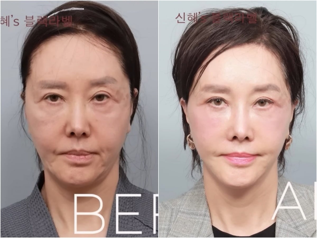배우 유혜리의 성형 전과 후 비교 사진. / 사진='BLACKLABEL: 하이엔드메이크오버쇼' 유튜브 영상 캡처