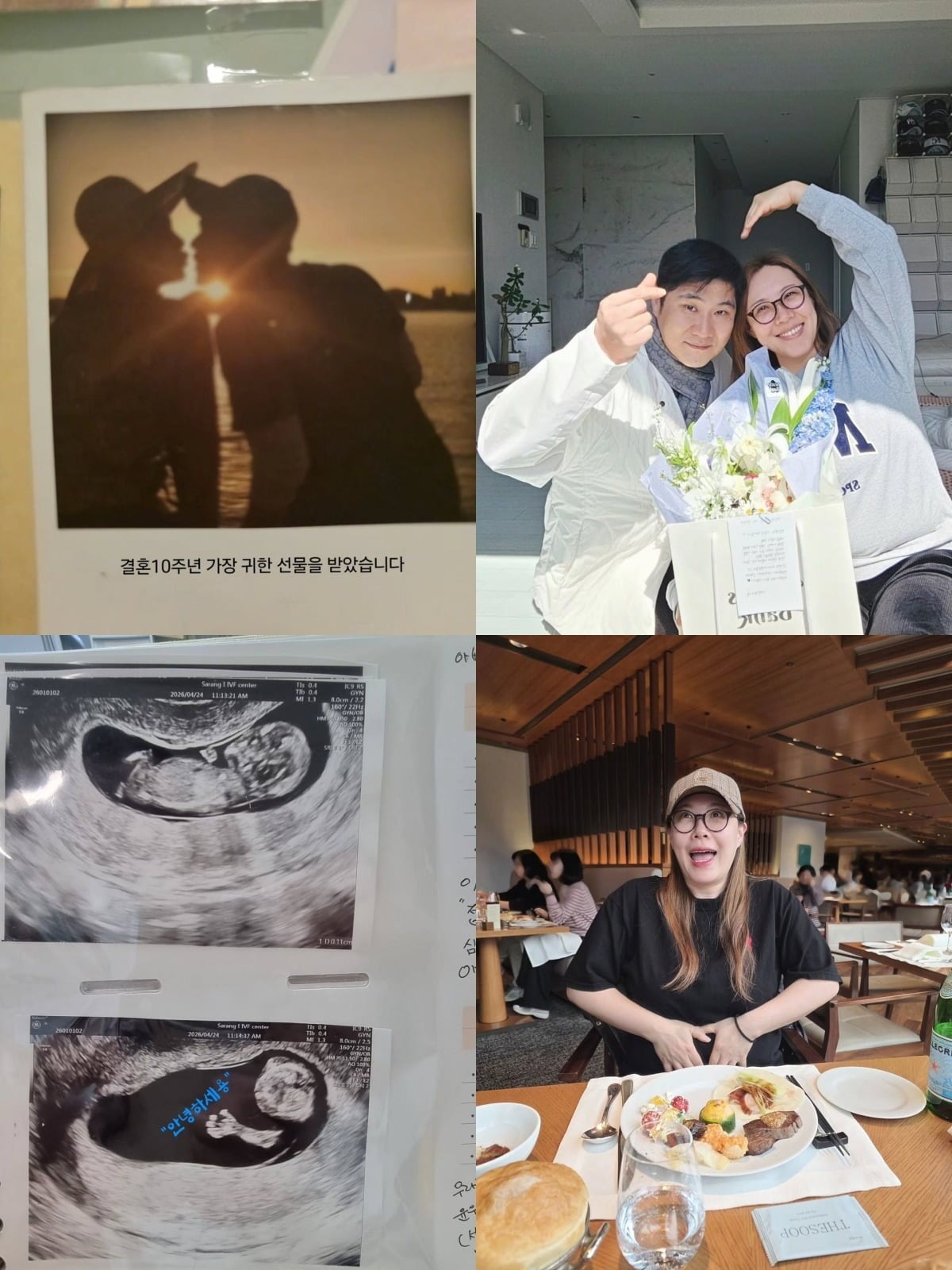 개그우먼 이희경이 임신 사실을 밝혔다. / 사진=이희경 SNS