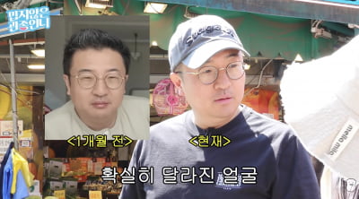 얼굴 반쪽 됐네…'♥이지혜' 문재완, 마운자로 맞고 몰라보게 달라진 비주얼에 '깜짝'