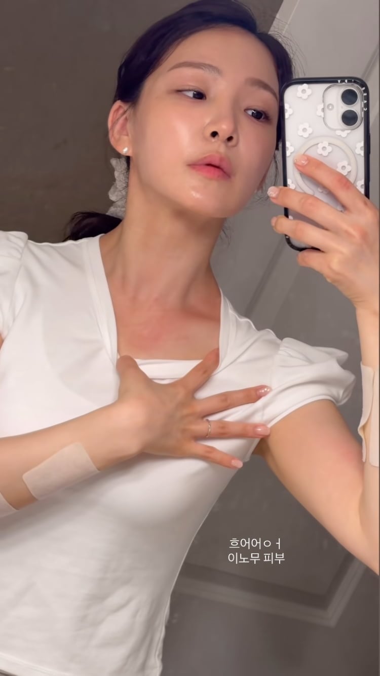 이아영, 재혼 3개월 남았는데…하와이서 알러지로 고생중
