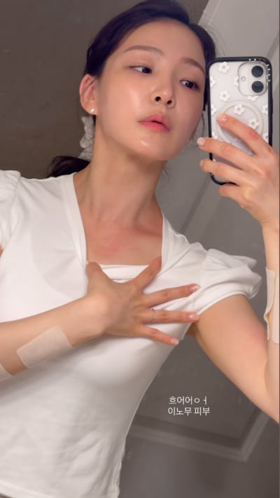 이아영, 재혼 3개월 남았는데…하와이서 알러지로 고생중