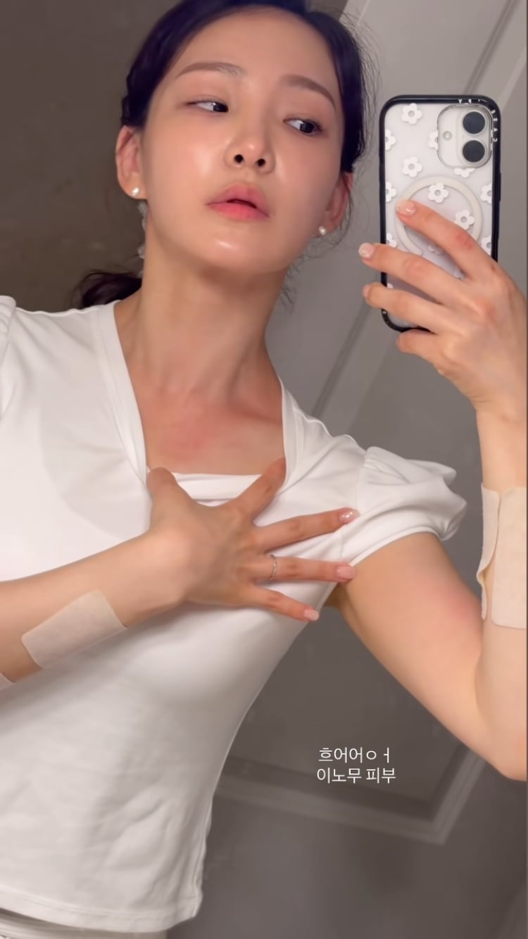 이아영, 재혼 3개월 남았는데…하와이서 알러지로 고생중