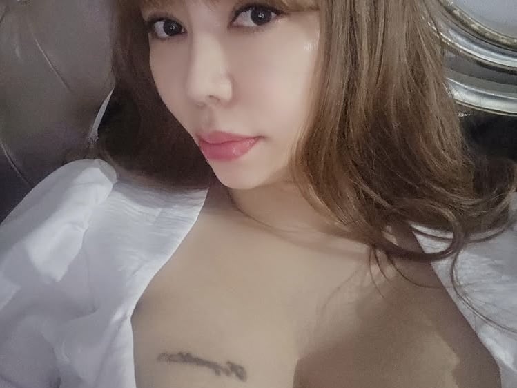 10기 정숙, 재산만 80억인데…가슴 때문에 계속 생고생