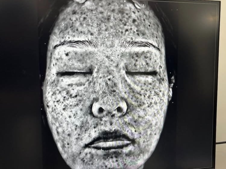 개그우먼 미자가 피부 상태를 공개하며 관리의 중요성을 강조했다./SNS