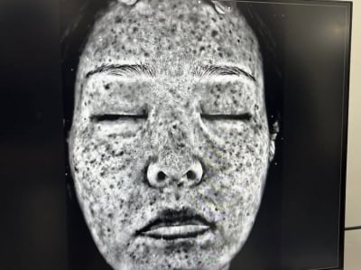 '김태현♥' 미자, 기미가 왜 이렇게 심해…최악 피부 상태에 깜짝