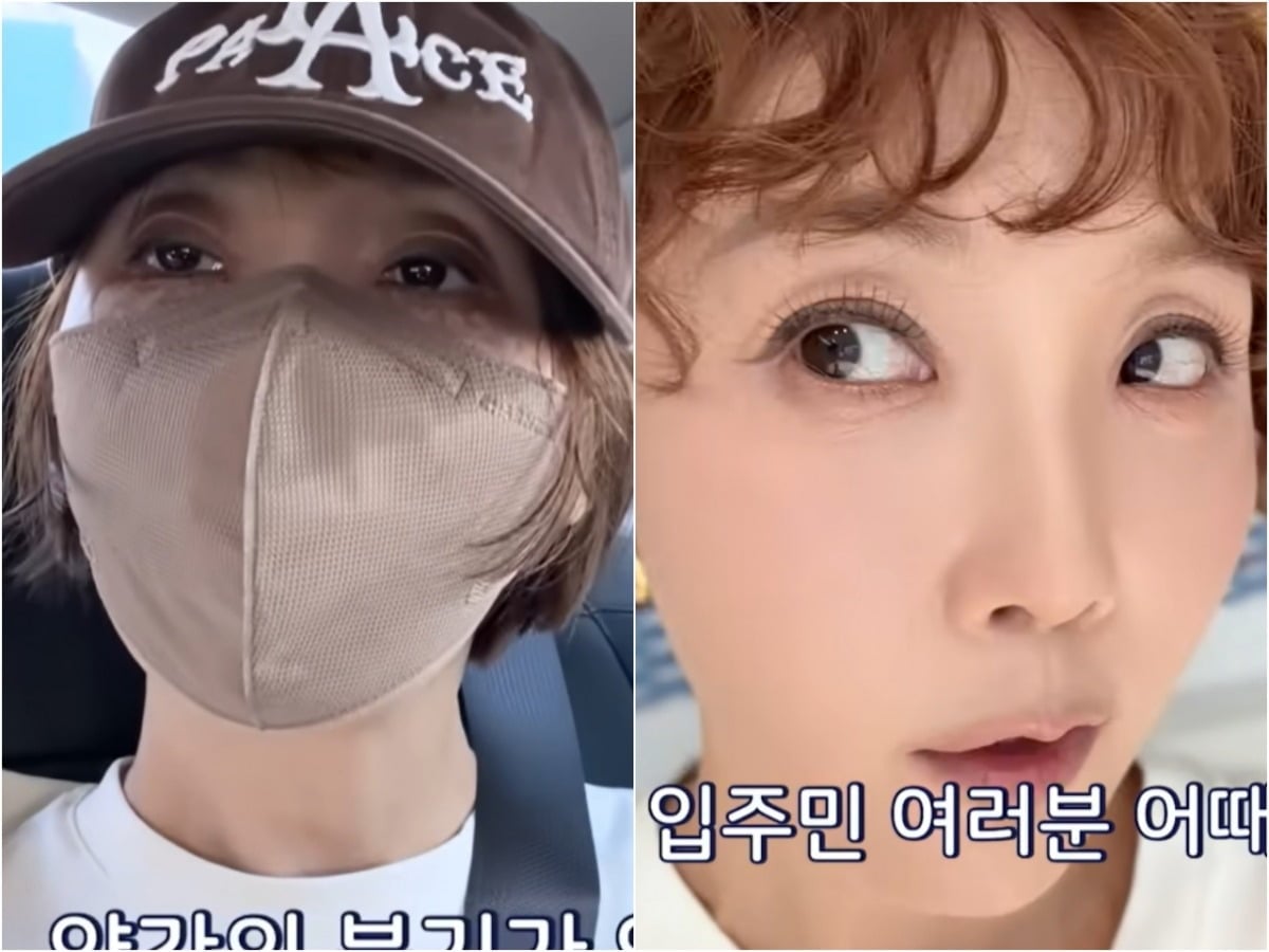 최은경이 자신의 유튜브 채널을 통해 눈밑지방 재배치 수술 후기를 전했다. / 사진='최은경의 관리사무소' 유튜브 영상 캡처