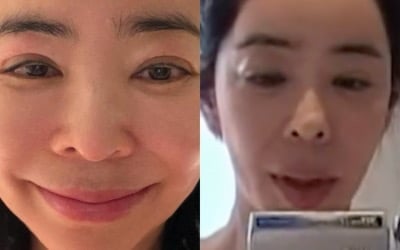 '5년 암 투병' 이혜영, 얼굴 몰라보게 달라진 이유 있었다…"눈 붓기, 사실은 유착 증상 때문"