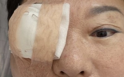 '73세' 양희은, 또 다시 건강 적신호…'난소암·시한부 선고'에 이어 각막이식 수술까지