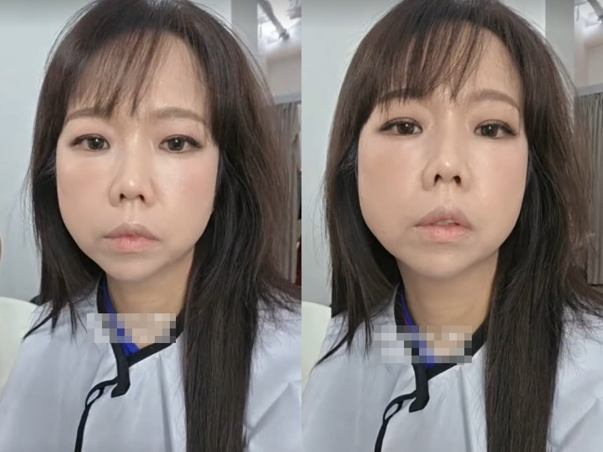 개그우먼 홍현희가 수척해진 얼굴을 보이고 있다. / 사진=홍현희 SNS