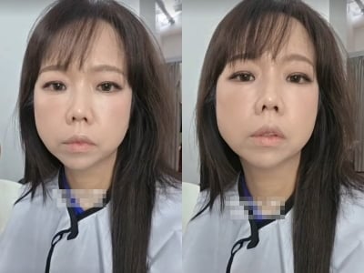 49kg 진입한 홍현희, 살이 빠지다 못해 수척…눈까지 충혈