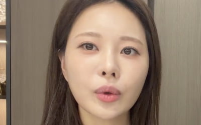 '전신 피멍' 아옳이, 4년 만에 또 시술 부작용 호소…"보톡스 맞고 눈 사시 돼"