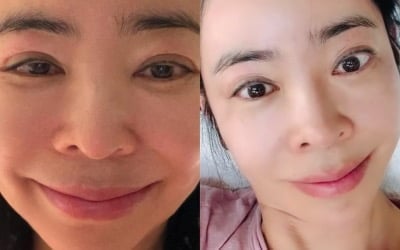 "붓기 많이 빠졌네"… '암 투병' 이혜영, 유착 고백 8일 만에 되찾은 명품 눈매