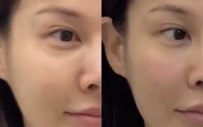 10년은 젊어졌네…'43세' 아이비, 인상 확 달라진 이유는 "시술" 쿨 고백