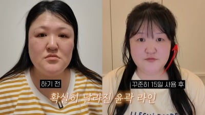'40세' 이국주, 몰라보게 달라진 턱선…"나이 드니까 처져, 매일 관리 중"