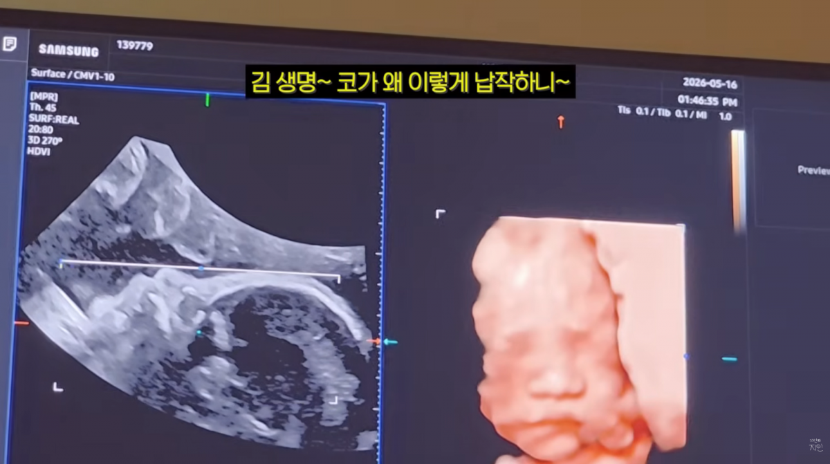 사진=문지인 유튜브