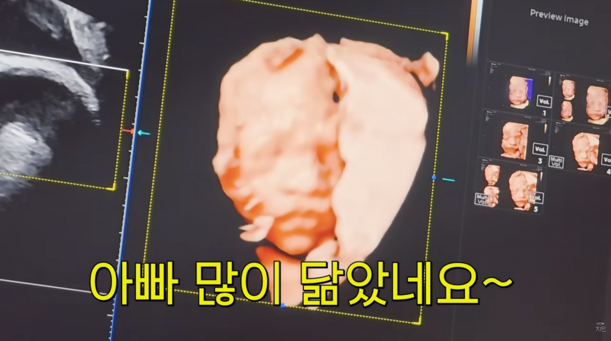 사진=문지인 유튜브