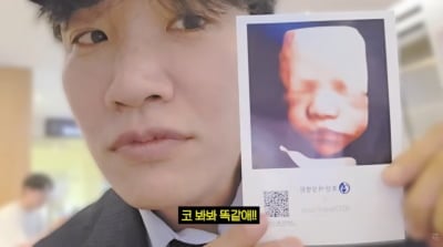 '문지인♥' 김기리, 子 얼굴 보고 당황…"나 닮아 코 납작, 살짝 미안"