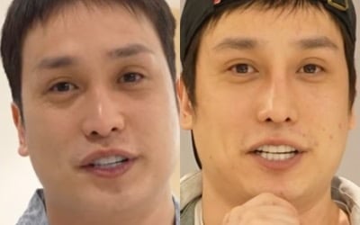 '제아 출신' 김태헌, 성형 이후 AI도 몰라보게 달라진 비주얼…"얼굴 인식도 안 돼"