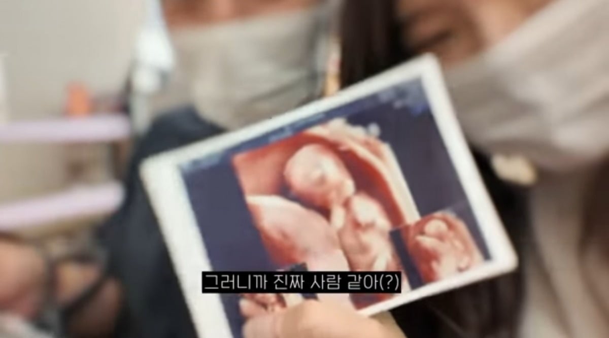 사진 = '홍아림' 유튜브 채널 캡처