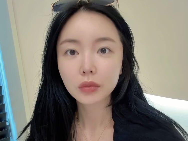 홍진영, 레이저 리프팅 시술받아…주름도 없이 팽팽하네