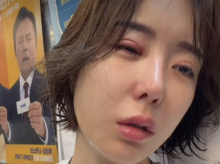 ‘가슴성형 1000만원’ 이소라, 눈 퉁퉁…혼자 여행가서 눈물 주르륵