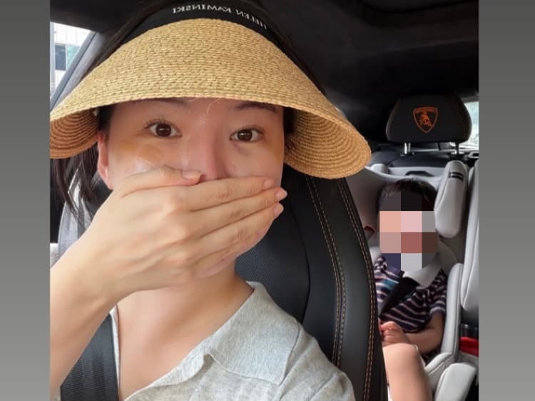 모델 하늘, 가정 폭력 아니라고 해명…얼굴은 밴드 붙이고 만신창이
