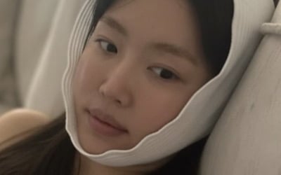 '눈 성형만 7번' 강예원, 앞트임 복원 이어 얼굴에 압박붕대 '칭칭' 감은 사연