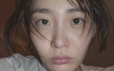김민하, 17kg 감량했다더니…볼살 하나 없는 초췌 민낯 '깜짝 공개'