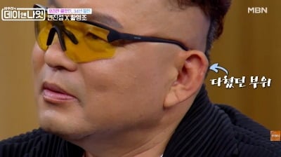 "정신 차려보니 피가 줄줄"…황영조, 골프공 사고 회상 "50바늘 꿰맸다"