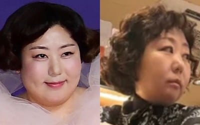 '110kg' 신기루, 마운자로 의혹 부른 핼쑥 비주얼…"도려내는 수준으로 포토샵해" 실토