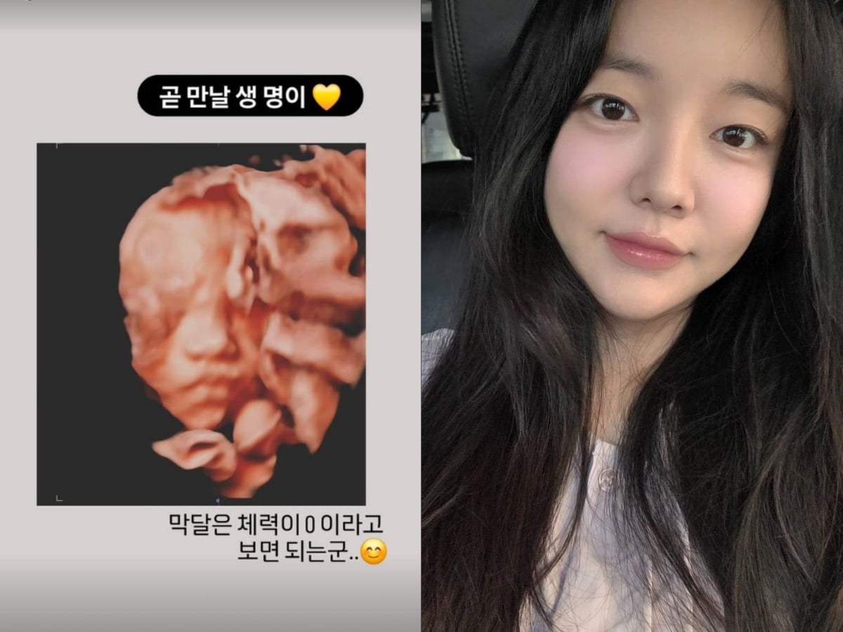 문지인이 아기 초음파 사진을 공개했다. / 사진=문지인 SNS