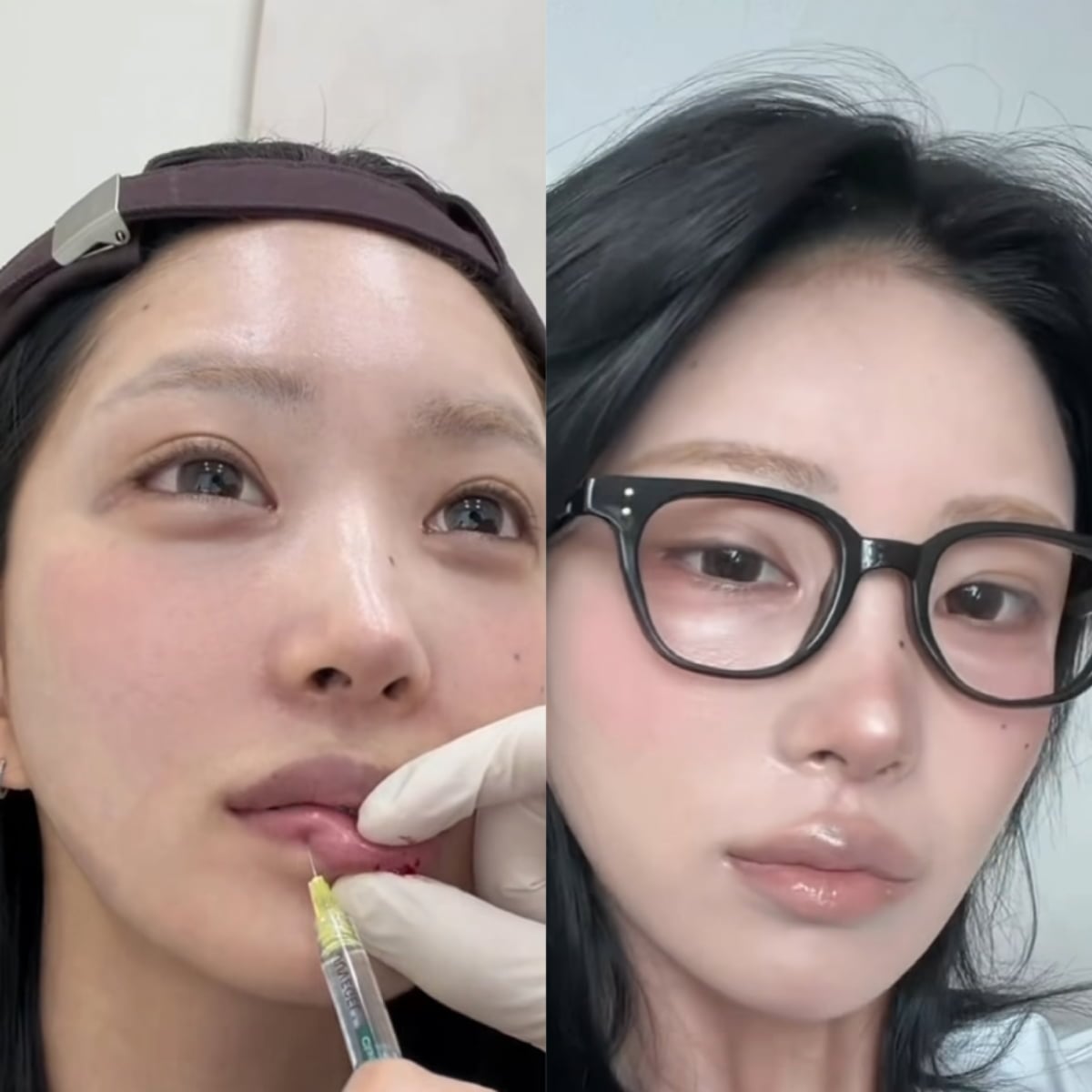 최준희 / 사진 = 최준희 SNS