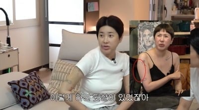 "워터밤 출연료 다 썼다" 서인영, 팔에 푸른 멍 가득…"전신마취 후 지방 흡입"