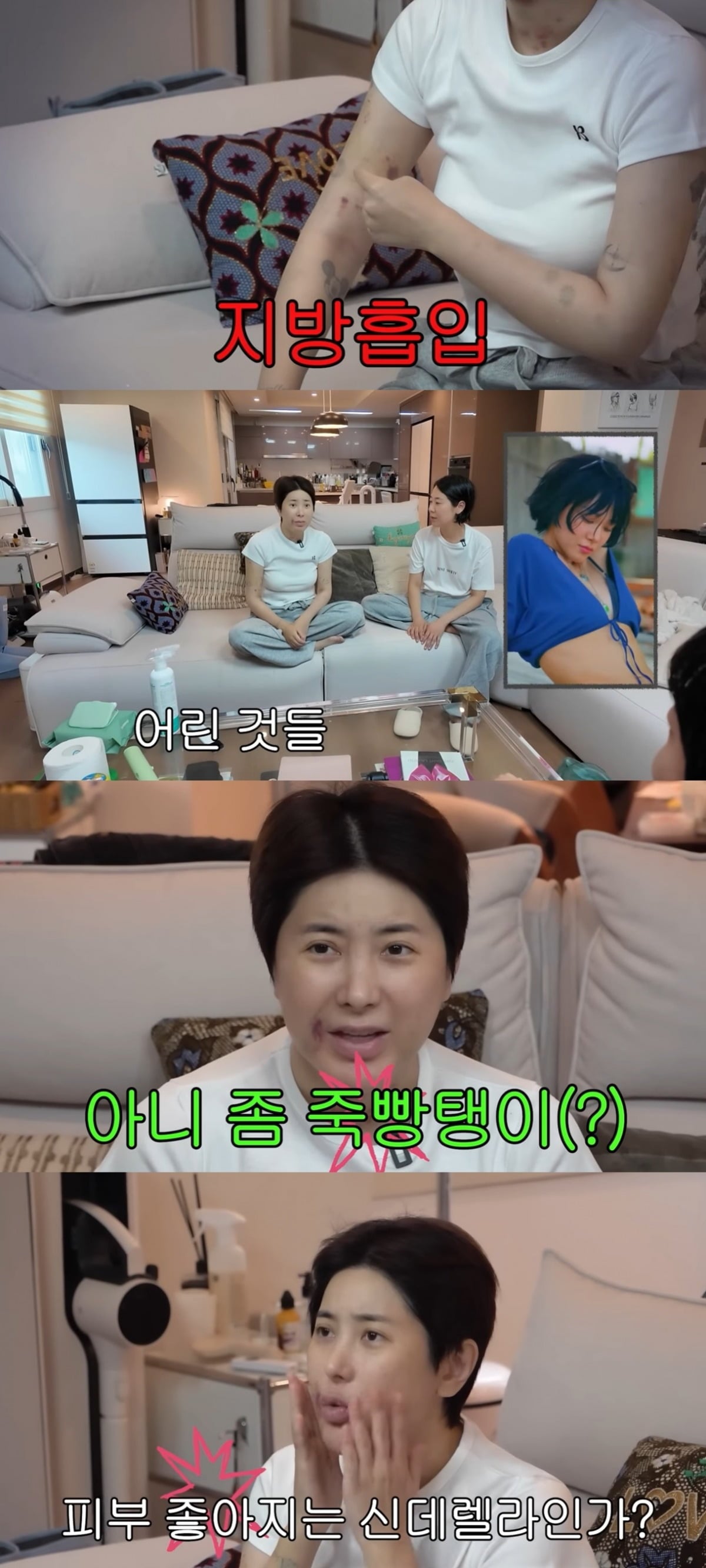 서인영이 '워터밤 속초 2026' 무대를 앞두고 팔 지방흡입과 각종 시술을 받았다고 밝혔다./사진=서인영 유튜브 채널 캡처