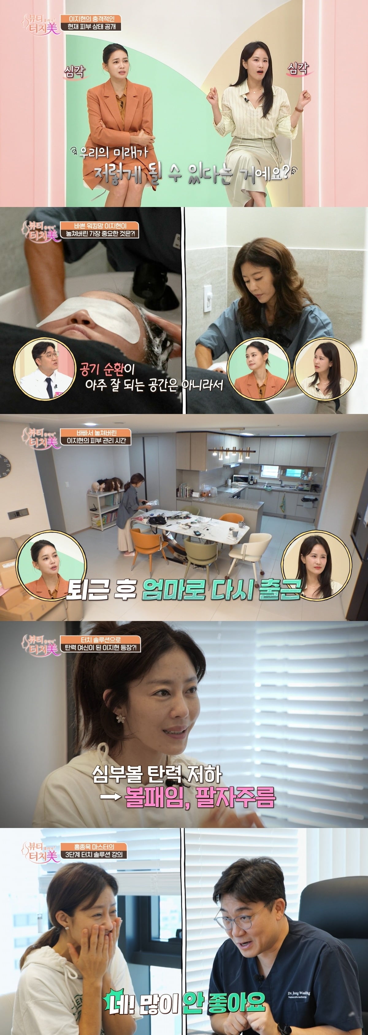 쥬얼리 출신 이지현이 방송 최초로 민낯을 공개하며 피부 고민을 털어놓는다./사진제공=채널A