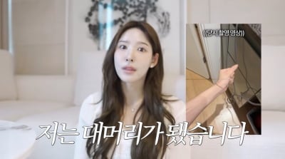이나연, 모발이식 부작용…"대머리 됐다, 30cm 날아가" ('일단')