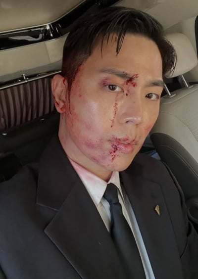 얼굴 다 터진 걸스데이 소진 남편…"수고했어요" 댓글에 깜찍한 반전 답변