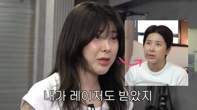 "서인영 맞아?" 몰라보게 달라진 얼굴...시술 부작용 "표정이 잘 안돼" ('개과천선')