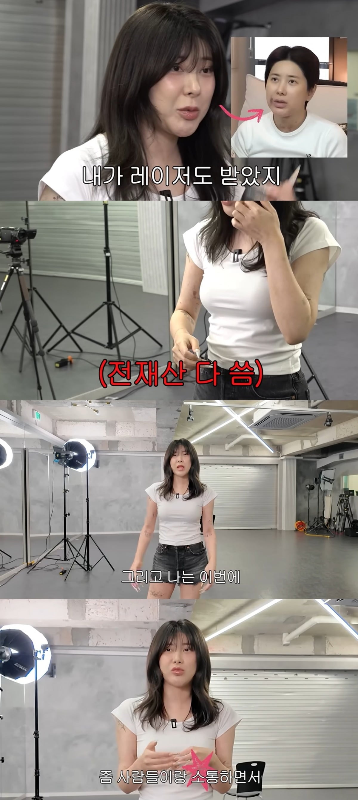 가수 서인영이 워터밤 무대를 앞두고 피부 시술과 지방흡입까지 감행한 근황을 공개했다./사진=서인영 유튜브 캡처