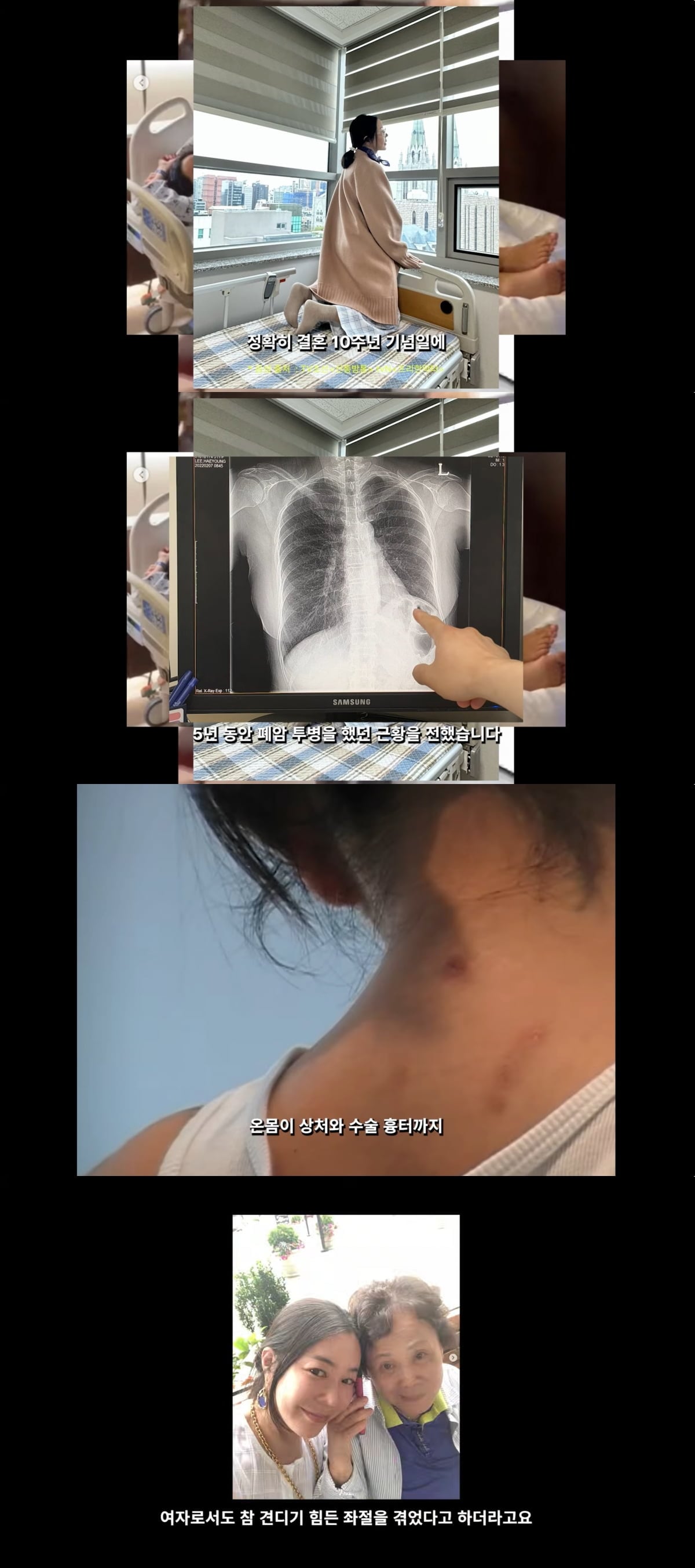 '폐암 투병 6년' 이혜영, 母와 하루 차이로 암 진단..."4년 동안 숨겼다"