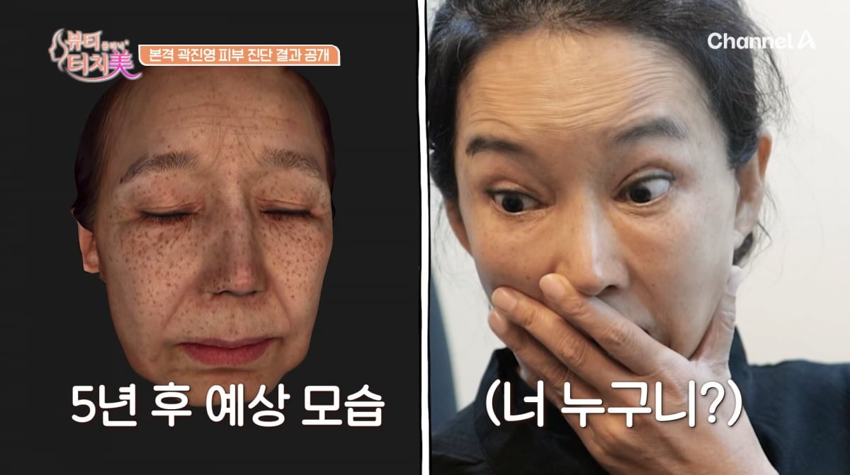 사진=채널A '뷰티 클리닉 터치미'