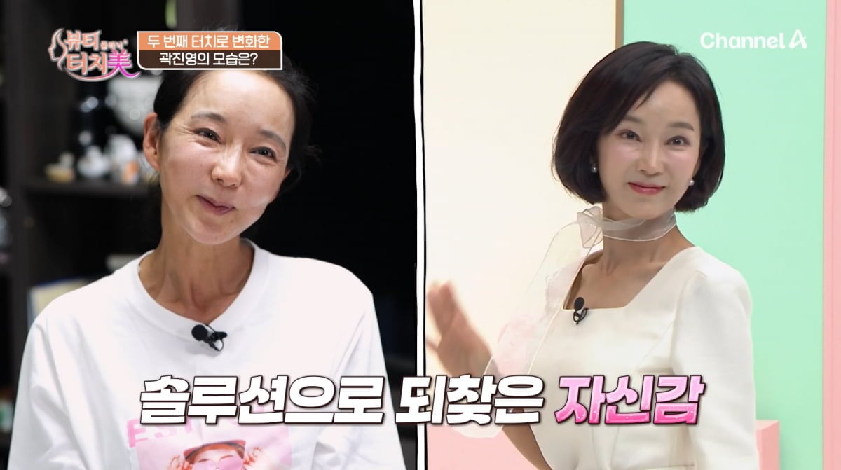 사진=채널A '뷰티 클리닉 터치미'