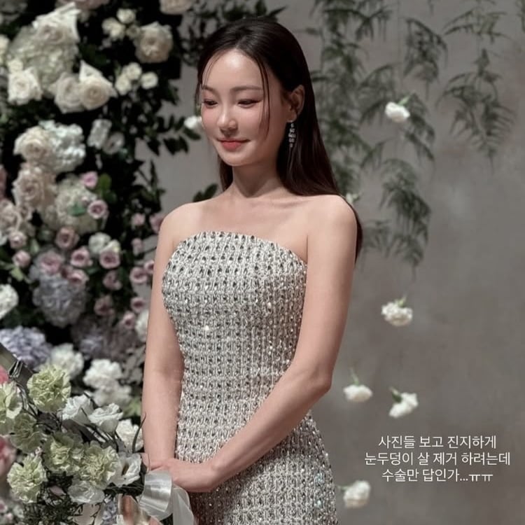 “눈두덩이 살 제거, 수술만 답인가”…이아영, ‘재혼’하자마자 성형 고민