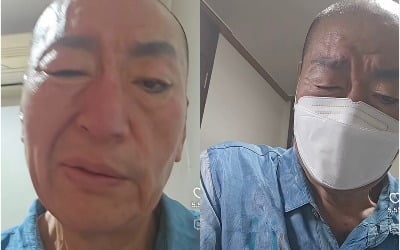 '69세' 유퉁, 안면마비 증상에 팬들 깜짝…"눈 안 감기고 입 돌아가"