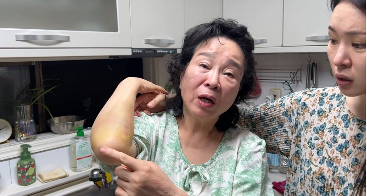 미자, 주식도 망했는데…“母 욕실서 넘어져 응급실行, 돌아가신 줄 알았다”